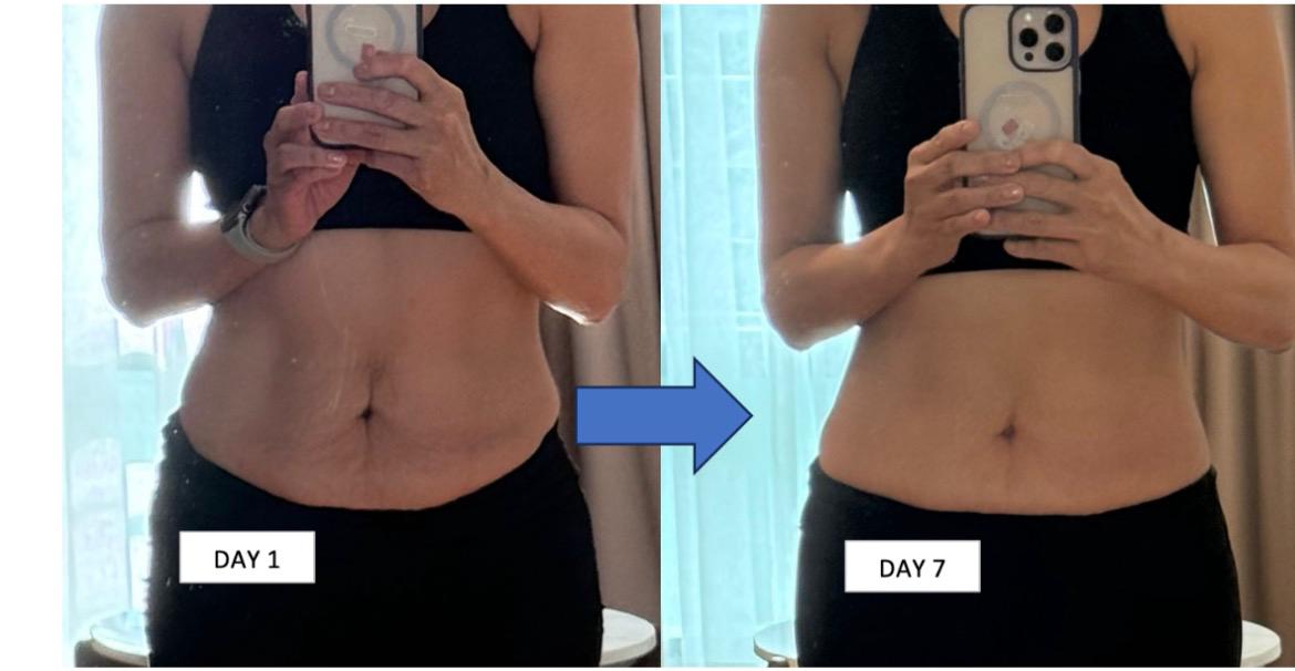 Before and after result from the Flat Tummy program